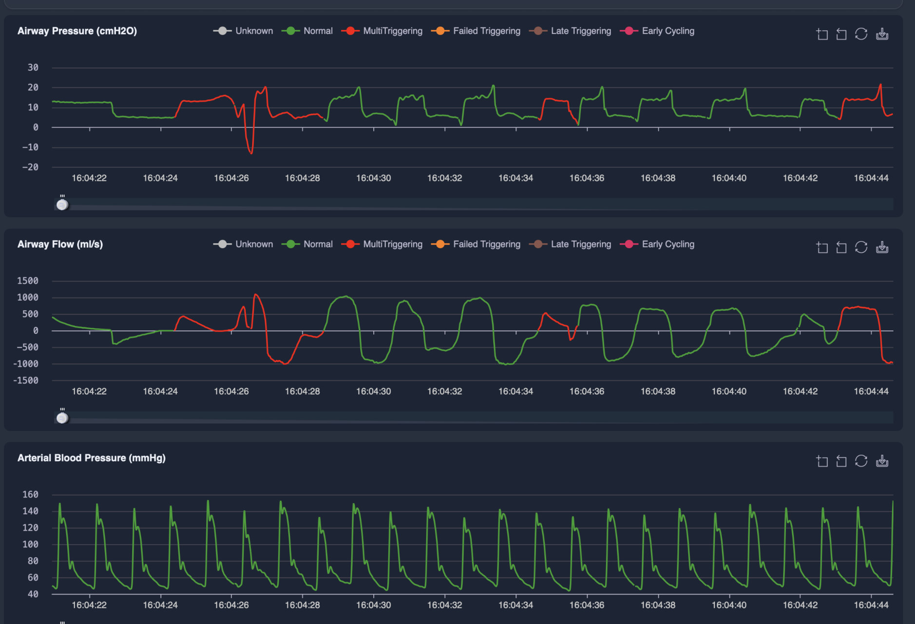 Airway pressure, flow and arterial blood pressure waveforms with trigger classification