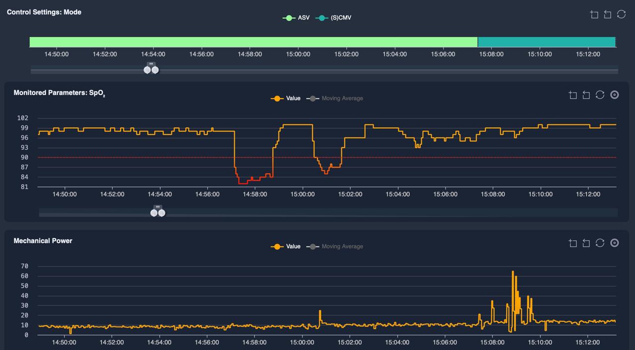 Granular Ventilator Data Collection for Smarter ICU Care