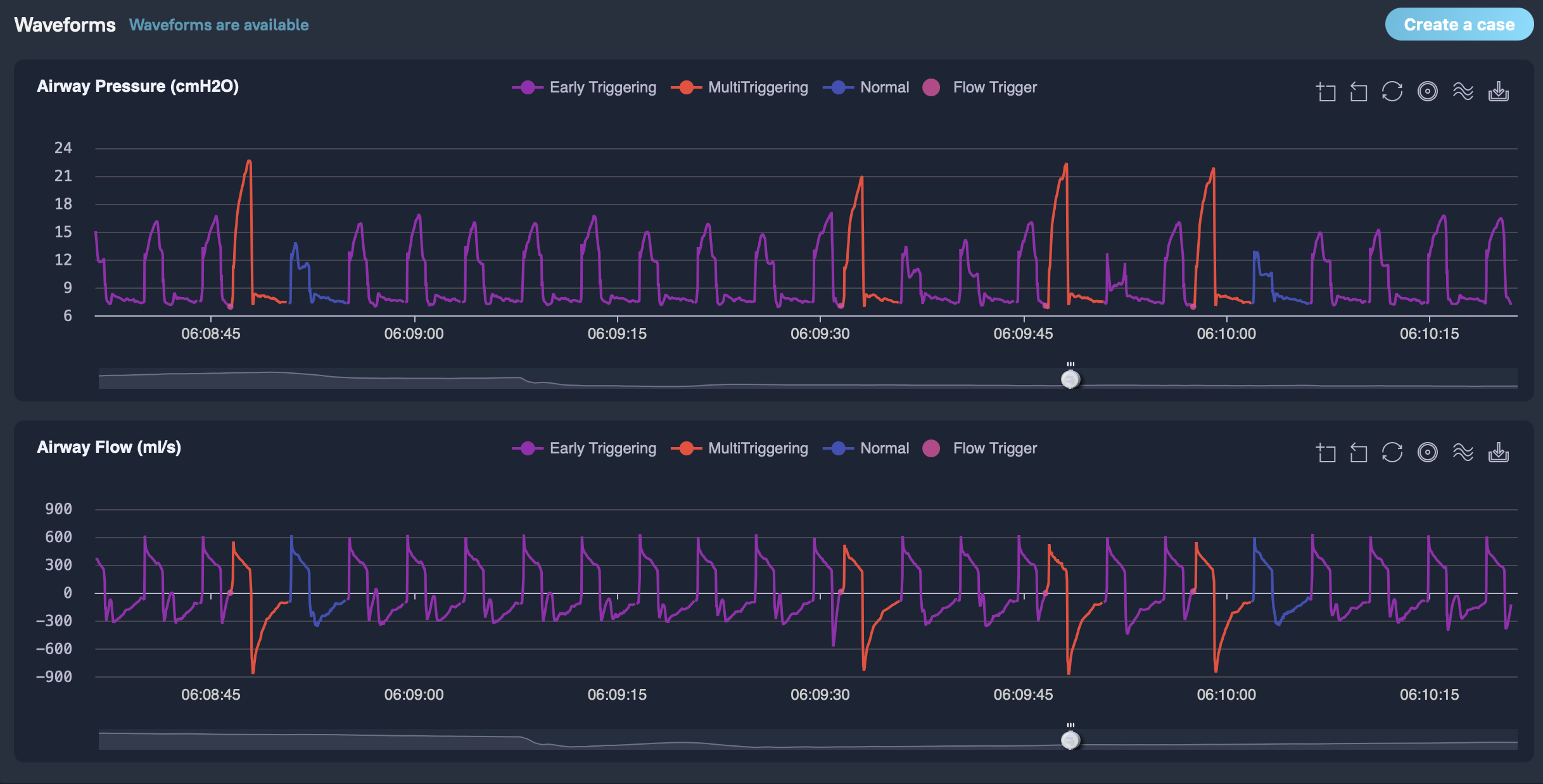 High-Frequency ICU Data Collection from Ventilators and Patient Monitors